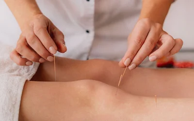 How Can Dry Needling Help Your Pain?